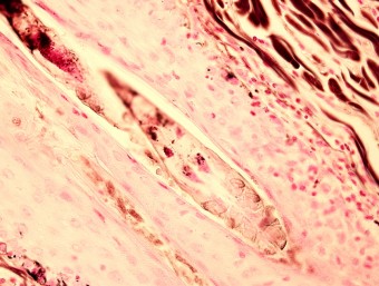 Demodex, skin, dog