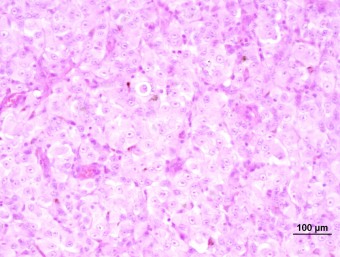 oral melanoma baloon type, dog
