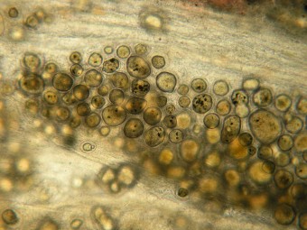 fish mycobacteriosis, fresh mount, mesenterium