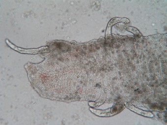 gills, monogenea