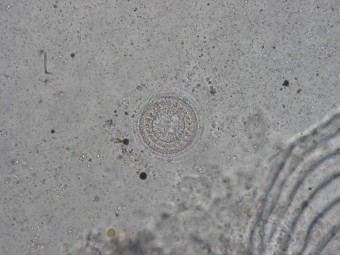 Trichodina
